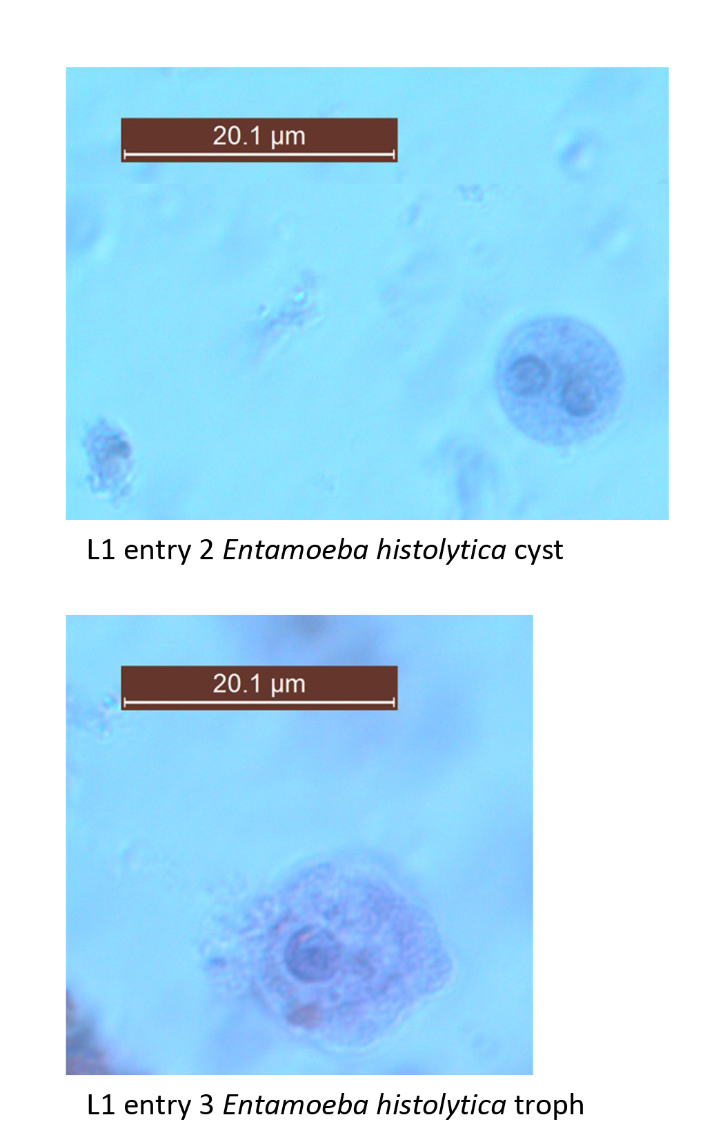 Entamoeba histolytica