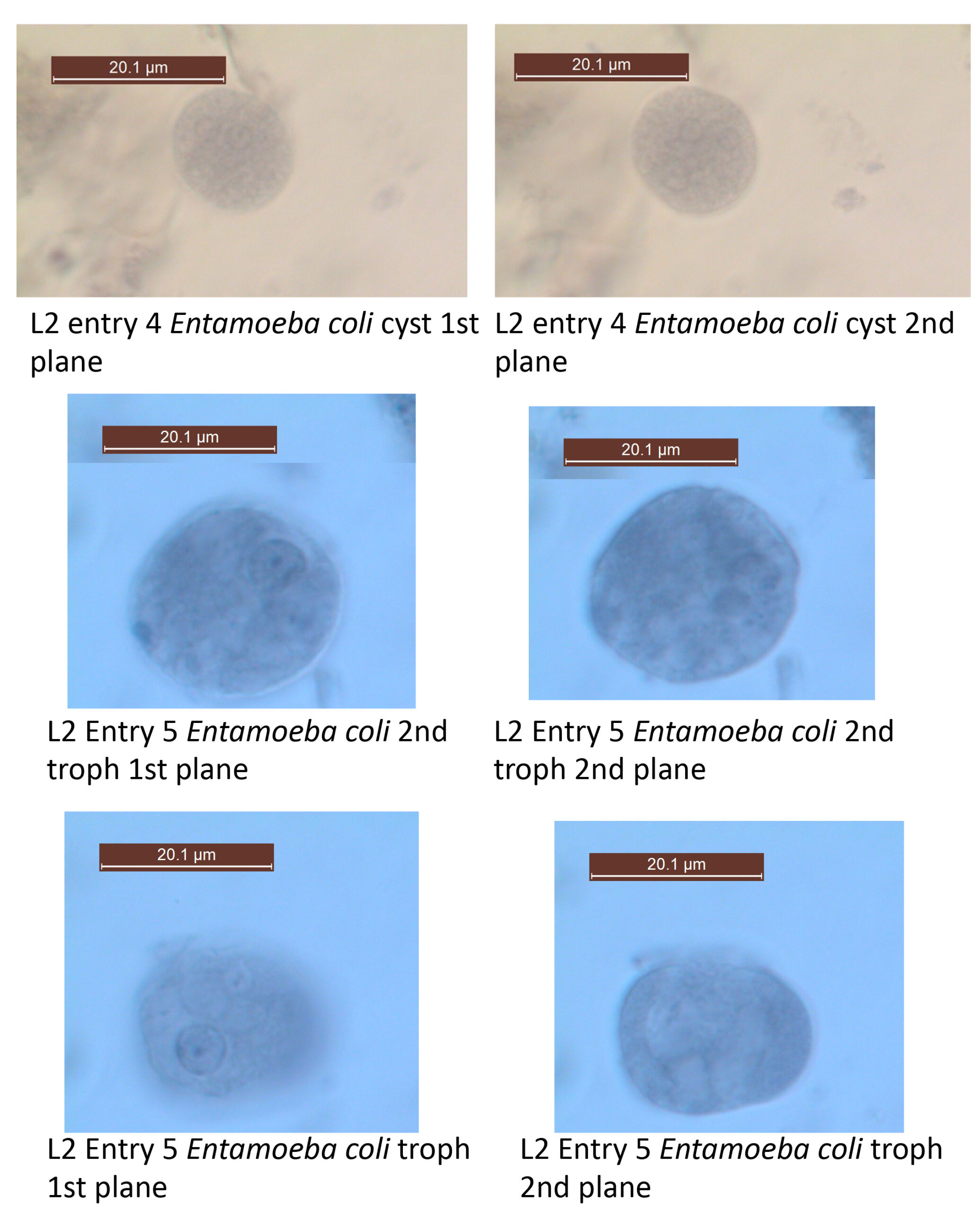 Entamoeba coli cysts and trophs