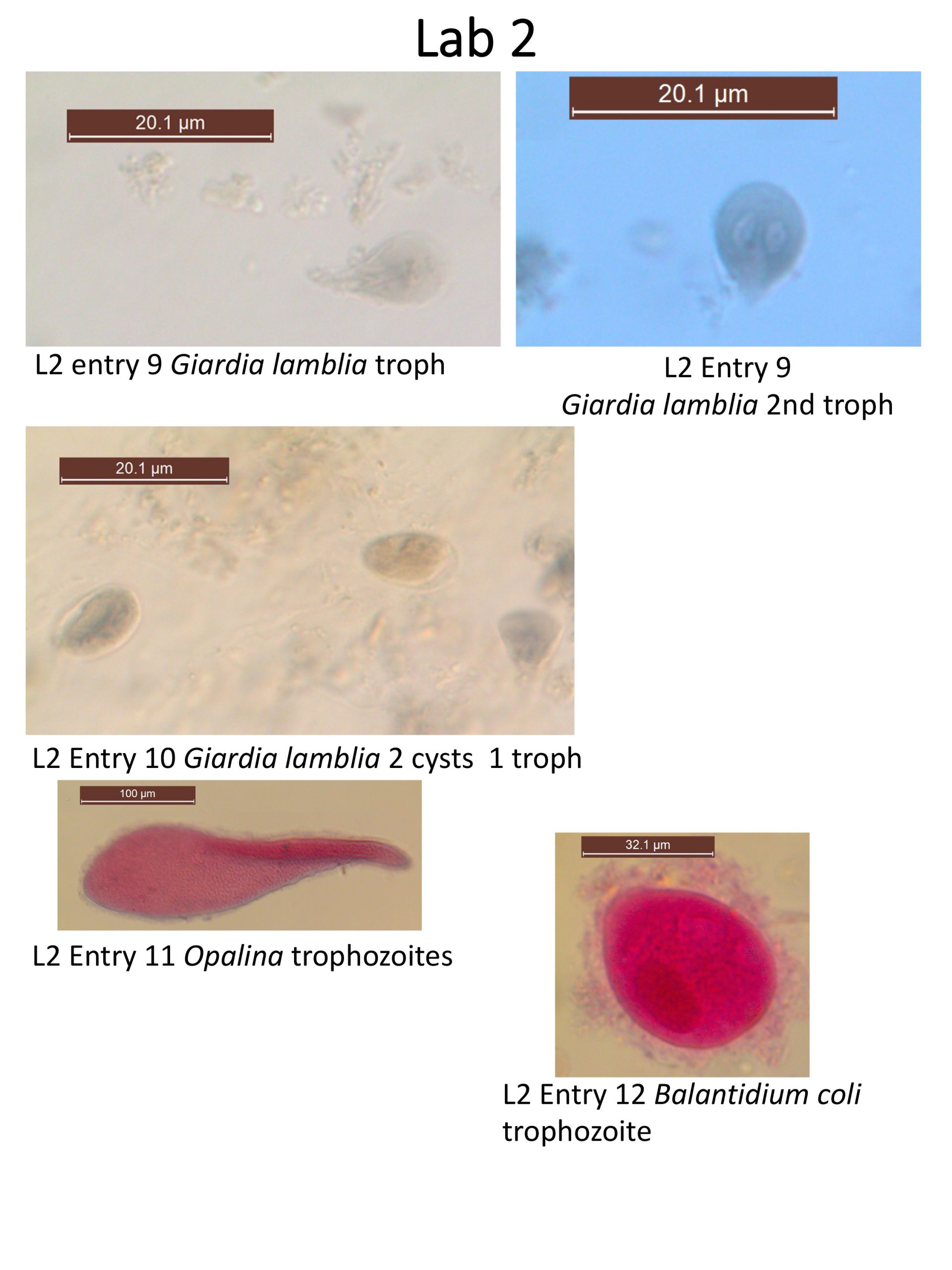 Giardia troph and cyst; Opalina troph; Balantidium troph