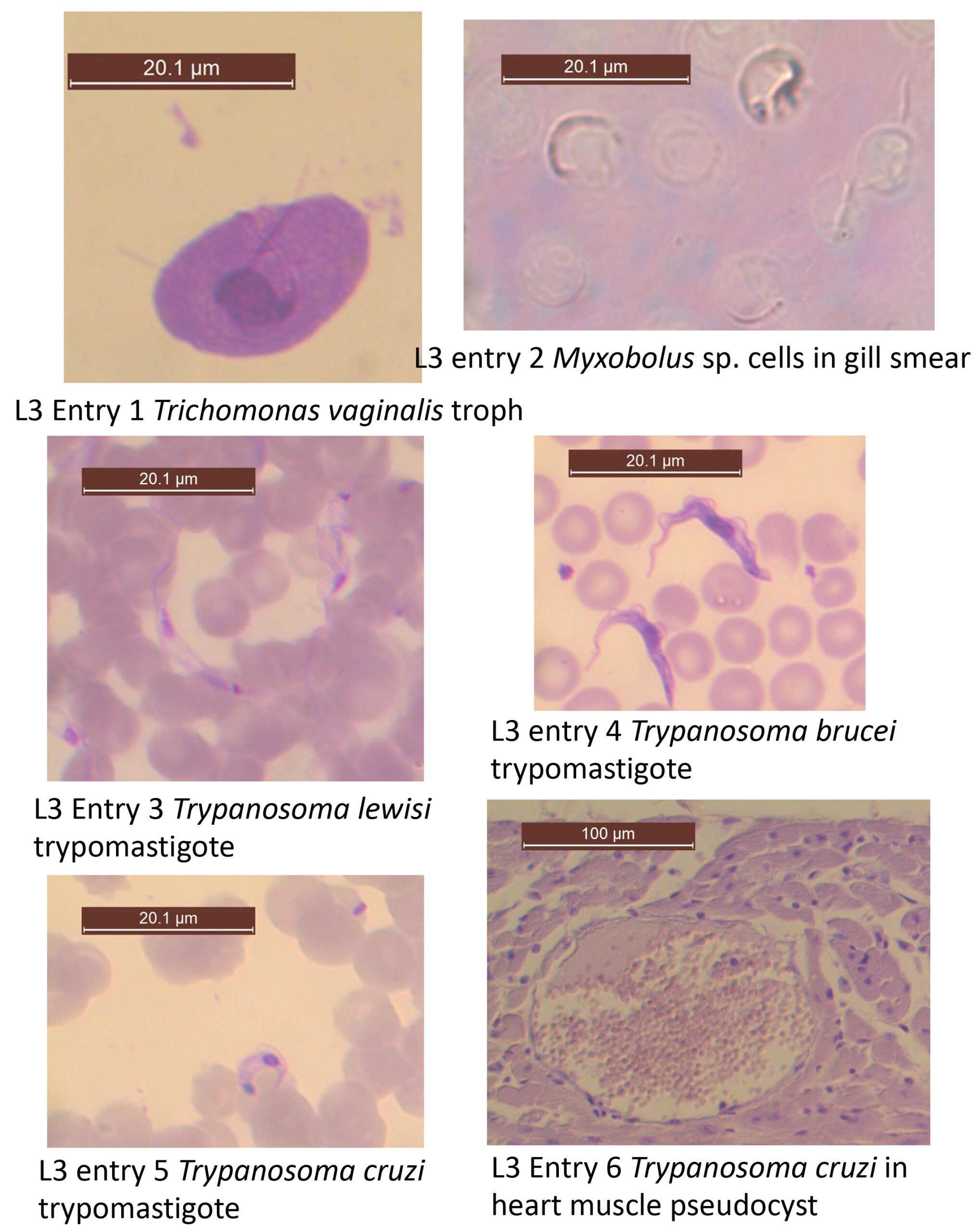 Images of Trichomonas vaginalis, Myxobolus, Trypanosoma lewisi, Trypanosoma brucei, Trypanosoma cruzi.